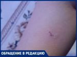 «Бродячие псы напали на сына и прокусили ногу»: мама школьника просить очистить улицы Волгодонска от четвероногой опасности